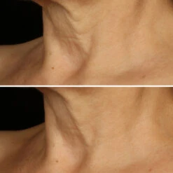 Clinique Smart Clinical Repair - Crème Liftante Visage + Cou -Soins Du Corps Soldes smart clinical repair creme liftante visage cou 4