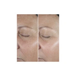 Clinique Smart Clinical Repair Serum - Sérum Correcteur Anti-Rides -Soins Du Corps Soldes smart clinical repair serum serum correcteur anti rides 6